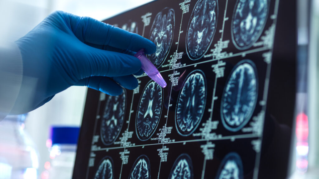 a doctor examining an X-ray and brain scans