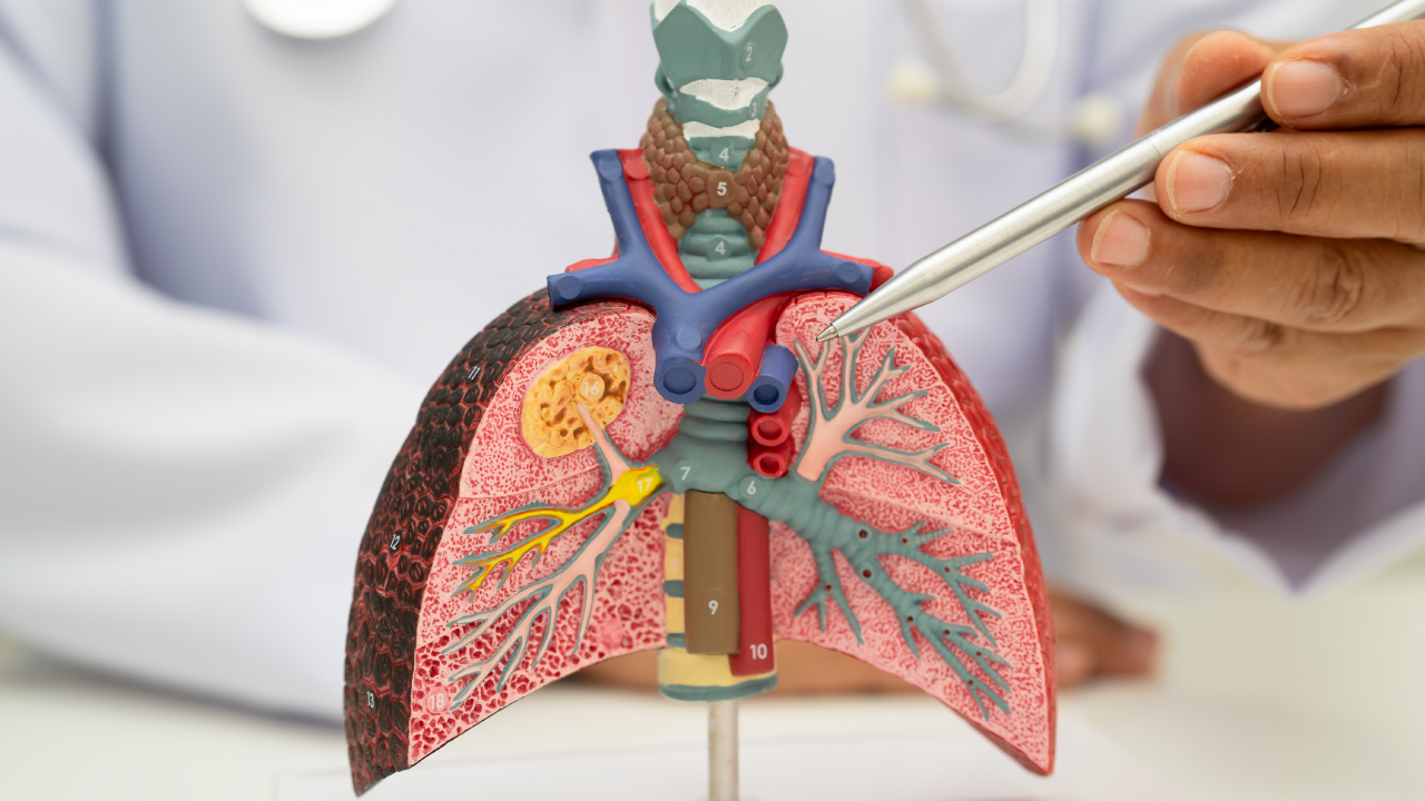 COPD: the cough that should not be ignored